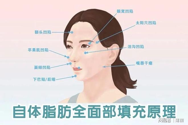 脂肪填充后幾天開始存活，全面解析脂肪填充過程及其恢復(fù)時(shí)間，全面解析脂肪填充過程，術(shù)后幾天脂肪開始存活及恢復(fù)時(shí)間揭秘