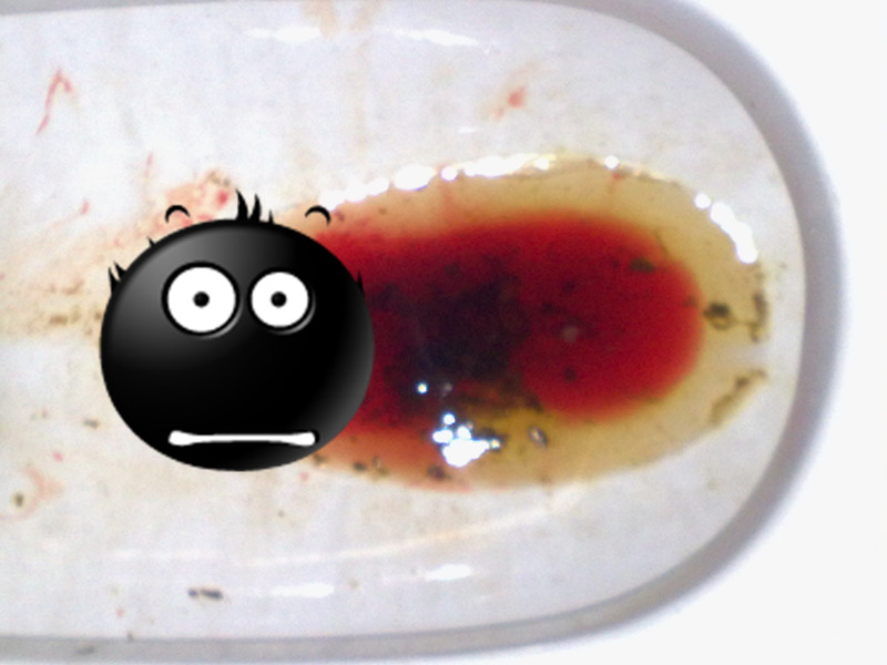 拉屎出血但不疼，原因分析及應(yīng)對(duì)措施，拉屎出血但不疼，原因解析與應(yīng)對(duì)策略