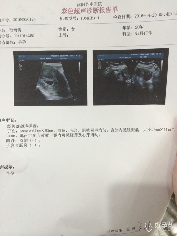 懷孕多少天可以查出來，全面解析早期妊娠檢測方式，懷孕多少天可以檢測出來？早期妊娠檢測方式的全面解析