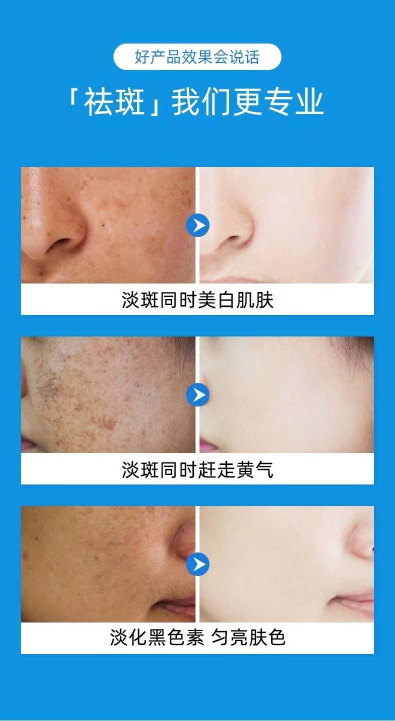 揭秘祛斑最佳方法，如何達(dá)到最佳祛斑效果？，揭秘最佳祛斑方法，實(shí)現(xiàn)最佳效果的秘訣！