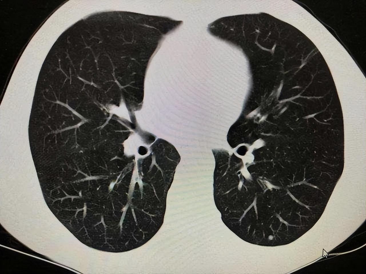 新聞咨詢 第64頁