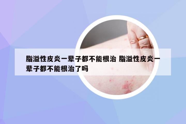 脂溢性皮炎，并非終身無法根治的疾病，脂溢性皮炎并非無法根治，治療策略助你擺脫困擾